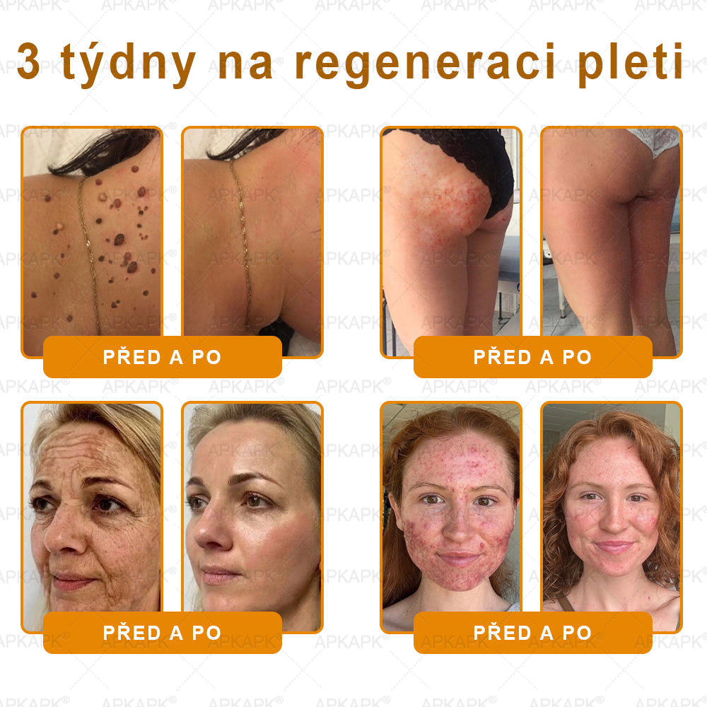 𝐀𝐏𝐊𝐀𝐏𝐊® 𝐌é𝐡𝐦é𝐫𝐞𝐠 Á𝐭𝐟𝐨𝐠ó 𝐤𝐫é𝐦 (🐝𝐬𝐞𝐠í𝐭 𝐦𝐞𝐠𝐨𝐥𝐝𝐚𝐧𝐢 𝐚𝐳 𝐚𝐥á𝐛𝐛𝐢 𝐛ő𝐫𝐩𝐫𝐨𝐛𝐥é𝐦á𝐤𝐚𝐭: 𝐫á𝐧𝐜𝐨𝐤, 𝐡𝐞𝐠𝐞𝐤, 𝐩𝐢𝐠𝐦𝐞𝐧𝐭𝐟𝐨𝐥𝐭𝐨𝐤, 𝐬𝐭𝐫𝐢á𝐤, 𝐩𝐚𝐭𝐭𝐚𝐧á𝐬𝐨𝐤, 𝐩𝐢𝐤𝐤𝐞𝐥𝐲𝐬ö𝐦ö𝐫, 𝐞𝐤𝐜é𝐦𝐚, 𝐛ő𝐫𝐞𝐥𝐯á𝐥𝐭𝐨𝐳á𝐬𝐨𝐤, 𝐢𝐫𝐫𝐢𝐭á𝐜𝐢ó𝐤, 𝐠𝐲𝐮𝐥𝐥𝐚𝐝á𝐬𝐨𝐤 é𝐬 𝐞𝐠𝐲é𝐛 𝐛ő𝐫𝐩𝐚𝐧𝐚𝐬𝐳𝐨𝐤)🔥