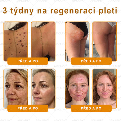 𝐀𝐏𝐊𝐀𝐏𝐊® 𝐌é𝐡𝐦é𝐫𝐞𝐠 Á𝐭𝐟𝐨𝐠ó 𝐤𝐫é𝐦 (🐝𝐬𝐞𝐠í𝐭 𝐦𝐞𝐠𝐨𝐥𝐝𝐚𝐧𝐢 𝐚𝐳 𝐚𝐥á𝐛𝐛𝐢 𝐛ő𝐫𝐩𝐫𝐨𝐛𝐥é𝐦á𝐤𝐚𝐭: 𝐫á𝐧𝐜𝐨𝐤, 𝐡𝐞𝐠𝐞𝐤, 𝐩𝐢𝐠𝐦𝐞𝐧𝐭𝐟𝐨𝐥𝐭𝐨𝐤, 𝐬𝐭𝐫𝐢á𝐤, 𝐩𝐚𝐭𝐭𝐚𝐧á𝐬𝐨𝐤, 𝐩𝐢𝐤𝐤𝐞𝐥𝐲𝐬ö𝐦ö𝐫, 𝐞𝐤𝐜é𝐦𝐚, 𝐛ő𝐫𝐞𝐥𝐯á𝐥𝐭𝐨𝐳á𝐬𝐨𝐤, 𝐢𝐫𝐫𝐢𝐭á𝐜𝐢ó𝐤, 𝐠𝐲𝐮𝐥𝐥𝐚𝐝á𝐬𝐨𝐤 é𝐬 𝐞𝐠𝐲é𝐛 𝐛ő𝐫𝐩𝐚𝐧𝐚𝐬𝐳𝐨𝐤)🔥