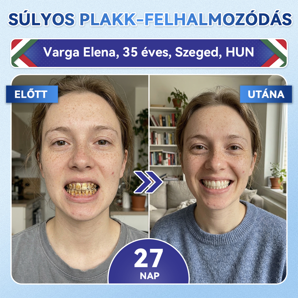 🦷 𝐆𝐥𝐢𝐦𝐦𝐞𝐫𝐥𝐲® 𝐓𝐢𝐝𝐞𝐠𝐥𝐮𝐬𝐢𝐛 𝐅𝐨𝐠- é𝐬 Í𝐧𝐲𝐫𝐞𝐠𝐞𝐧𝐞𝐫á𝐥ó 𝐌𝐢𝐤𝐫𝐨𝐭ű𝐬 𝐏á𝐫𝐧𝐚 | 𝐅𝐞𝐣𝐥𝐞𝐭𝐭 Ő𝐬𝐬𝐞𝐣𝐭𝐞𝐬 𝐀𝐤𝐭𝐢𝐯á𝐥á𝐬 𝐅𝐨𝐠𝐟𝐞𝐡é𝐫í𝐭ő 𝐂𝐬í𝐤𝐨𝐤 (🦷 𝐅𝐨𝐠𝐳𝐨𝐦á𝐧𝐜 é𝐬 𝐃𝐞𝐧𝐭𝐢𝐧 Ú𝐣𝐫𝐚é𝐩í𝐭é𝐬𝐞 • Í𝐧𝐲𝐞𝐫ő𝐬í𝐭é𝐬 • 𝐅𝐨𝐠𝐚𝐭𝐥𝐚𝐧𝐨𝐝á𝐬 é𝐬 𝐒𝐳𝐚𝐠𝐞𝐥𝐭á𝐯𝐨𝐥í𝐭á𝐬 • 𝐅𝐨𝐠é𝐫𝐳é𝐤𝐞𝐧𝐲𝐬é𝐠 𝐌𝐞𝐠á𝐥𝐥í𝐭á𝐬𝐚)🦷