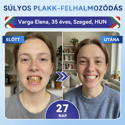 🦷 𝐆𝐥𝐢𝐦𝐦𝐞𝐫𝐥𝐲® 𝐓𝐢𝐝𝐞𝐠𝐥𝐮𝐬𝐢𝐛 𝐅𝐨𝐠- é𝐬 Í𝐧𝐲𝐫𝐞𝐠𝐞𝐧𝐞𝐫á𝐥ó 𝐌𝐢𝐤𝐫𝐨𝐭ű𝐬 𝐏á𝐫𝐧𝐚 | 𝐅𝐞𝐣𝐥𝐞𝐭𝐭 Ő𝐬𝐬𝐞𝐣𝐭𝐞𝐬 𝐀𝐤𝐭𝐢𝐯á𝐥á𝐬 𝐅𝐨𝐠𝐟𝐞𝐡é𝐫í𝐭ő 𝐂𝐬í𝐤𝐨𝐤 (🦷 𝐅𝐨𝐠𝐳𝐨𝐦á𝐧𝐜 é𝐬 𝐃𝐞𝐧𝐭𝐢𝐧 Ú𝐣𝐫𝐚é𝐩í𝐭é𝐬𝐞 • Í𝐧𝐲𝐞𝐫ő𝐬í𝐭é𝐬 • 𝐅𝐨𝐠𝐚𝐭𝐥𝐚𝐧𝐨𝐝á𝐬 é𝐬 𝐒𝐳𝐚𝐠𝐞𝐥𝐭á𝐯𝐨𝐥í𝐭á𝐬 • 𝐅𝐨𝐠é𝐫𝐳é𝐤𝐞𝐧𝐲𝐬é𝐠 𝐌𝐞𝐠á𝐥𝐥í𝐭á𝐬𝐚)🦷