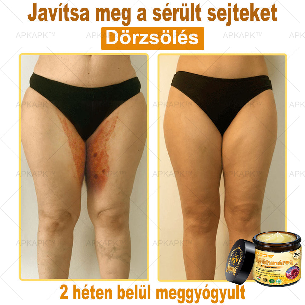 𝐀𝐏𝐊𝐀𝐏𝐊® 𝐌é𝐡𝐦é𝐫𝐞𝐠 Á𝐭𝐟𝐨𝐠ó 𝐤𝐫é𝐦 (🐝𝐬𝐞𝐠í𝐭 𝐦𝐞𝐠𝐨𝐥𝐝𝐚𝐧𝐢 𝐚𝐳 𝐚𝐥á𝐛𝐛𝐢 𝐛ő𝐫𝐩𝐫𝐨𝐛𝐥é𝐦á𝐤𝐚𝐭: 𝐫á𝐧𝐜𝐨𝐤, 𝐡𝐞𝐠𝐞𝐤, 𝐩𝐢𝐠𝐦𝐞𝐧𝐭𝐟𝐨𝐥𝐭𝐨𝐤, 𝐬𝐭𝐫𝐢á𝐤, 𝐩𝐚𝐭𝐭𝐚𝐧á𝐬𝐨𝐤, 𝐩𝐢𝐤𝐤𝐞𝐥𝐲𝐬ö𝐦ö𝐫, 𝐞𝐤𝐜é𝐦𝐚, 𝐛ő𝐫𝐞𝐥𝐯á𝐥𝐭𝐨𝐳á𝐬𝐨𝐤, 𝐢𝐫𝐫𝐢𝐭á𝐜𝐢ó𝐤, 𝐠𝐲𝐮𝐥𝐥𝐚𝐝á𝐬𝐨𝐤 é𝐬 𝐞𝐠𝐲é𝐛 𝐛ő𝐫𝐩𝐚𝐧𝐚𝐬𝐳𝐨𝐤)🔥
