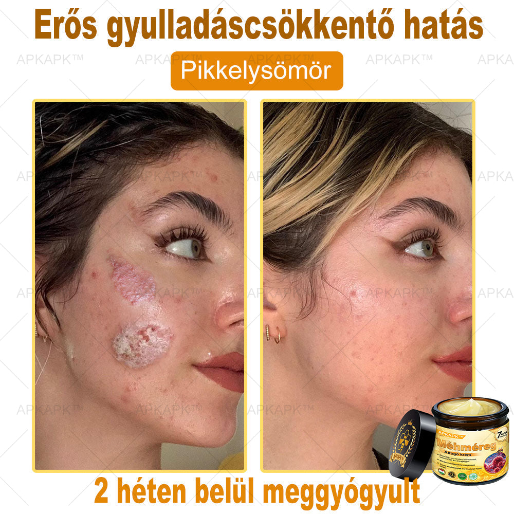𝐀𝐏𝐊𝐀𝐏𝐊® 𝐌é𝐡𝐦é𝐫𝐞𝐠 Á𝐭𝐟𝐨𝐠ó 𝐤𝐫é𝐦 (🐝𝐬𝐞𝐠í𝐭 𝐦𝐞𝐠𝐨𝐥𝐝𝐚𝐧𝐢 𝐚𝐳 𝐚𝐥á𝐛𝐛𝐢 𝐛ő𝐫𝐩𝐫𝐨𝐛𝐥é𝐦á𝐤𝐚𝐭: 𝐫á𝐧𝐜𝐨𝐤, 𝐡𝐞𝐠𝐞𝐤, 𝐩𝐢𝐠𝐦𝐞𝐧𝐭𝐟𝐨𝐥𝐭𝐨𝐤, 𝐬𝐭𝐫𝐢á𝐤, 𝐩𝐚𝐭𝐭𝐚𝐧á𝐬𝐨𝐤, 𝐩𝐢𝐤𝐤𝐞𝐥𝐲𝐬ö𝐦ö𝐫, 𝐞𝐤𝐜é𝐦𝐚, 𝐛ő𝐫𝐞𝐥𝐯á𝐥𝐭𝐨𝐳á𝐬𝐨𝐤, 𝐢𝐫𝐫𝐢𝐭á𝐜𝐢ó𝐤, 𝐠𝐲𝐮𝐥𝐥𝐚𝐝á𝐬𝐨𝐤 é𝐬 𝐞𝐠𝐲é𝐛 𝐛ő𝐫𝐩𝐚𝐧𝐚𝐬𝐳𝐨𝐤)🔥