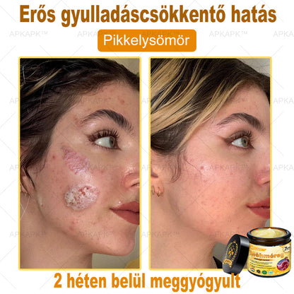 𝐀𝐏𝐊𝐀𝐏𝐊® 𝐌é𝐡𝐦é𝐫𝐞𝐠 Á𝐭𝐟𝐨𝐠ó 𝐤𝐫é𝐦 (🐝𝐬𝐞𝐠í𝐭 𝐦𝐞𝐠𝐨𝐥𝐝𝐚𝐧𝐢 𝐚𝐳 𝐚𝐥á𝐛𝐛𝐢 𝐛ő𝐫𝐩𝐫𝐨𝐛𝐥é𝐦á𝐤𝐚𝐭: 𝐫á𝐧𝐜𝐨𝐤, 𝐡𝐞𝐠𝐞𝐤, 𝐩𝐢𝐠𝐦𝐞𝐧𝐭𝐟𝐨𝐥𝐭𝐨𝐤, 𝐬𝐭𝐫𝐢á𝐤, 𝐩𝐚𝐭𝐭𝐚𝐧á𝐬𝐨𝐤, 𝐩𝐢𝐤𝐤𝐞𝐥𝐲𝐬ö𝐦ö𝐫, 𝐞𝐤𝐜é𝐦𝐚, 𝐛ő𝐫𝐞𝐥𝐯á𝐥𝐭𝐨𝐳á𝐬𝐨𝐤, 𝐢𝐫𝐫𝐢𝐭á𝐜𝐢ó𝐤, 𝐠𝐲𝐮𝐥𝐥𝐚𝐝á𝐬𝐨𝐤 é𝐬 𝐞𝐠𝐲é𝐛 𝐛ő𝐫𝐩𝐚𝐧𝐚𝐬𝐳𝐨𝐤)🔥