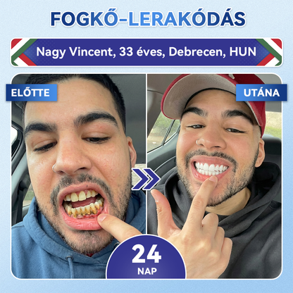 🦷 𝐆𝐥𝐢𝐦𝐦𝐞𝐫𝐥𝐲® 𝐓𝐢𝐝𝐞𝐠𝐥𝐮𝐬𝐢𝐛 𝐅𝐨𝐠- é𝐬 Í𝐧𝐲𝐫𝐞𝐠𝐞𝐧𝐞𝐫á𝐥ó 𝐌𝐢𝐤𝐫𝐨𝐭ű𝐬 𝐏á𝐫𝐧𝐚 | 𝐅𝐞𝐣𝐥𝐞𝐭𝐭 Ő𝐬𝐬𝐞𝐣𝐭𝐞𝐬 𝐀𝐤𝐭𝐢𝐯á𝐥á𝐬 𝐅𝐨𝐠𝐟𝐞𝐡é𝐫í𝐭ő 𝐂𝐬í𝐤𝐨𝐤 (🦷 𝐅𝐨𝐠𝐳𝐨𝐦á𝐧𝐜 é𝐬 𝐃𝐞𝐧𝐭𝐢𝐧 Ú𝐣𝐫𝐚é𝐩í𝐭é𝐬𝐞 • Í𝐧𝐲𝐞𝐫ő𝐬í𝐭é𝐬 • 𝐅𝐨𝐠𝐚𝐭𝐥𝐚𝐧𝐨𝐝á𝐬 é𝐬 𝐒𝐳𝐚𝐠𝐞𝐥𝐭á𝐯𝐨𝐥í𝐭á𝐬 • 𝐅𝐨𝐠é𝐫𝐳é𝐤𝐞𝐧𝐲𝐬é𝐠 𝐌𝐞𝐠á𝐥𝐥í𝐭á𝐬𝐚)🦷