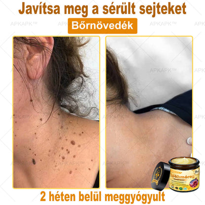 𝐀𝐏𝐊𝐀𝐏𝐊® 𝐌é𝐡𝐦é𝐫𝐞𝐠 Á𝐭𝐟𝐨𝐠ó 𝐤𝐫é𝐦 (🐝𝐬𝐞𝐠í𝐭 𝐦𝐞𝐠𝐨𝐥𝐝𝐚𝐧𝐢 𝐚𝐳 𝐚𝐥á𝐛𝐛𝐢 𝐛ő𝐫𝐩𝐫𝐨𝐛𝐥é𝐦á𝐤𝐚𝐭: 𝐫á𝐧𝐜𝐨𝐤, 𝐡𝐞𝐠𝐞𝐤, 𝐩𝐢𝐠𝐦𝐞𝐧𝐭𝐟𝐨𝐥𝐭𝐨𝐤, 𝐬𝐭𝐫𝐢á𝐤, 𝐩𝐚𝐭𝐭𝐚𝐧á𝐬𝐨𝐤, 𝐩𝐢𝐤𝐤𝐞𝐥𝐲𝐬ö𝐦ö𝐫, 𝐞𝐤𝐜é𝐦𝐚, 𝐛ő𝐫𝐞𝐥𝐯á𝐥𝐭𝐨𝐳á𝐬𝐨𝐤, 𝐢𝐫𝐫𝐢𝐭á𝐜𝐢ó𝐤, 𝐠𝐲𝐮𝐥𝐥𝐚𝐝á𝐬𝐨𝐤 é𝐬 𝐞𝐠𝐲é𝐛 𝐛ő𝐫𝐩𝐚𝐧𝐚𝐬𝐳𝐨𝐤)🔥