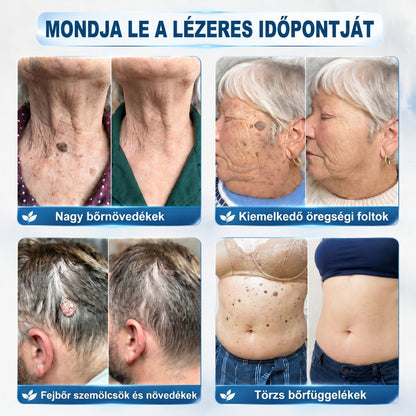 𝐇𝐢𝐯𝐚𝐭𝒂𝒍𝒐𝒔 𝒎á𝗿𝗸𝗮𝗯𝗼𝗹𝐭 | 🖊️ 𝐏i𝐜𝐝𝐨® 𝟕 𝐧𝐚𝒑𝒐𝒔 𝒔𝒛𝗲𝗺ö𝗹𝗰𝘀- é𝐬 𝐟𝐨𝐥𝐭𝐞𝐥í𝐭ó🌿
