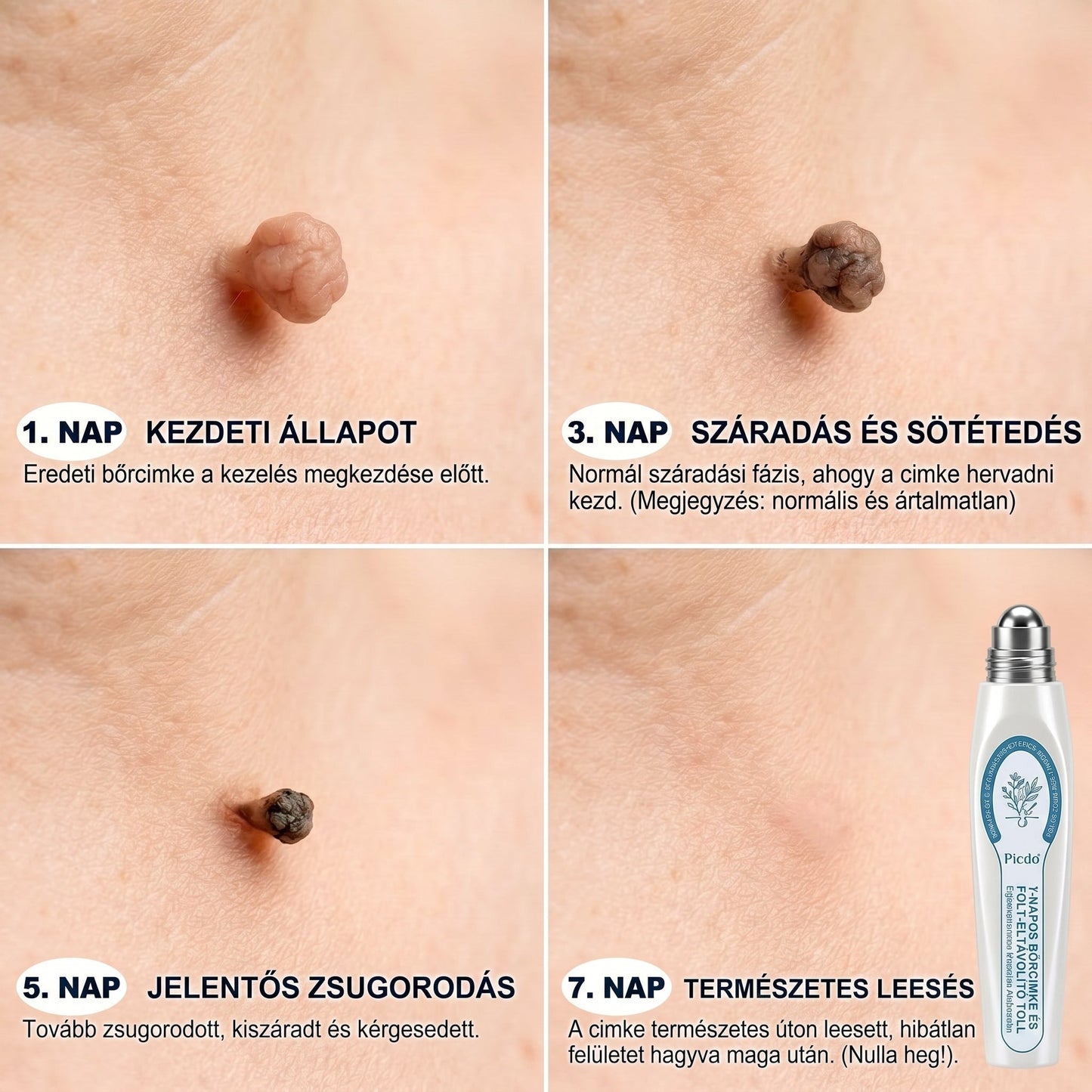 𝐇𝐢𝐯𝐚𝐭𝒂𝒍𝒐𝒔 𝒎á𝗿𝗸𝗮𝗯𝗼𝗹𝐭 | 🖊️ 𝐏i𝐜𝐝𝐨® 𝟕 𝐧𝐚𝒑𝒐𝒔 𝒔𝒛𝗲𝗺ö𝗹𝗰𝘀- é𝐬 𝐟𝐨𝐥𝐭𝐞𝐥í𝐭ó🌿