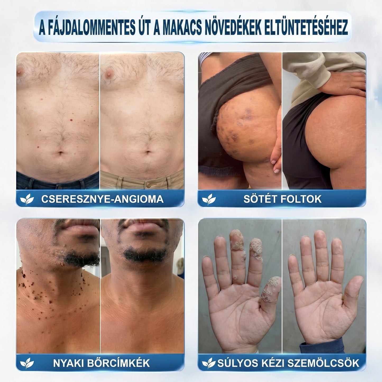 𝐇𝐢𝐯𝐚𝐭𝒂𝒍𝒐𝒔 𝒎á𝗿𝗸𝗮𝗯𝗼𝗹𝐭 | 🖊️ 𝐏i𝐜𝐝𝐨® 𝟕 𝐧𝐚𝒑𝒐𝒔 𝒔𝒛𝗲𝗺ö𝗹𝗰𝘀- é𝐬 𝐟𝐨𝐥𝐭𝐞𝐥í𝐭ó🌿