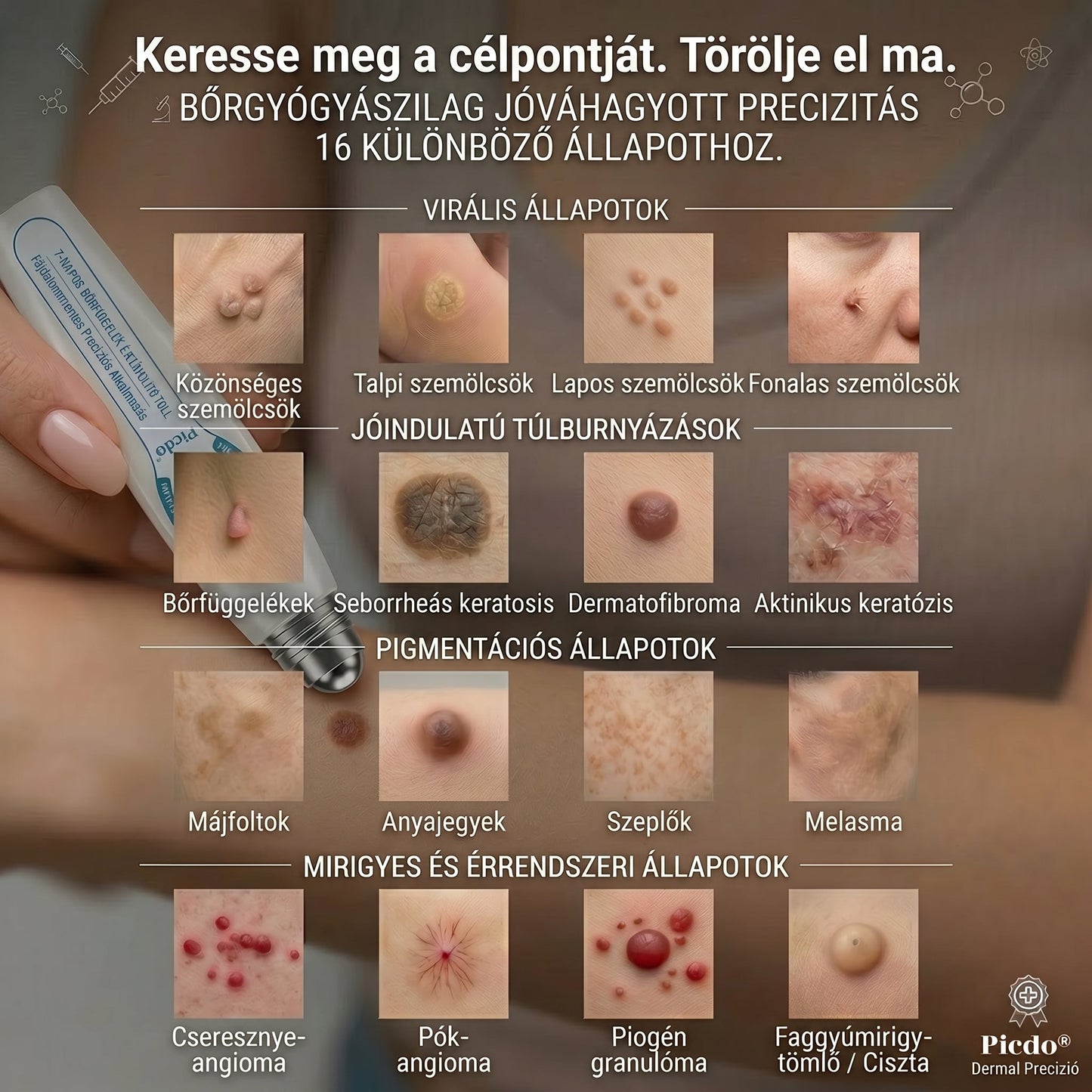 𝐇𝐢𝐯𝐚𝐭𝒂𝒍𝒐𝒔 𝒎á𝗿𝗸𝗮𝗯𝗼𝗹𝐭 | 🖊️ 𝐏i𝐜𝐝𝐨® 𝟕 𝐧𝐚𝒑𝒐𝒔 𝒔𝒛𝗲𝗺ö𝗹𝗰𝘀- é𝐬 𝐟𝐨𝐥𝐭𝐞𝐥í𝐭ó🌿