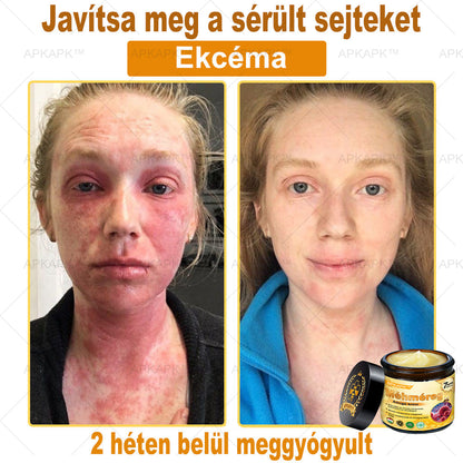 𝐀𝐏𝐊𝐀𝐏𝐊® 𝐌é𝐡𝐦é𝐫𝐞𝐠 Á𝐭𝐟𝐨𝐠ó 𝐤𝐫é𝐦 (🐝𝐬𝐞𝐠í𝐭 𝐦𝐞𝐠𝐨𝐥𝐝𝐚𝐧𝐢 𝐚𝐳 𝐚𝐥á𝐛𝐛𝐢 𝐛ő𝐫𝐩𝐫𝐨𝐛𝐥é𝐦á𝐤𝐚𝐭: 𝐫á𝐧𝐜𝐨𝐤, 𝐡𝐞𝐠𝐞𝐤, 𝐩𝐢𝐠𝐦𝐞𝐧𝐭𝐟𝐨𝐥𝐭𝐨𝐤, 𝐬𝐭𝐫𝐢á𝐤, 𝐩𝐚𝐭𝐭𝐚𝐧á𝐬𝐨𝐤, 𝐩𝐢𝐤𝐤𝐞𝐥𝐲𝐬ö𝐦ö𝐫, 𝐞𝐤𝐜é𝐦𝐚, 𝐛ő𝐫𝐞𝐥𝐯á𝐥𝐭𝐨𝐳á𝐬𝐨𝐤, 𝐢𝐫𝐫𝐢𝐭á𝐜𝐢ó𝐤, 𝐠𝐲𝐮𝐥𝐥𝐚𝐝á𝐬𝐨𝐤 é𝐬 𝐞𝐠𝐲é𝐛 𝐛ő𝐫𝐩𝐚𝐧𝐚𝐬𝐳𝐨𝐤)🔥