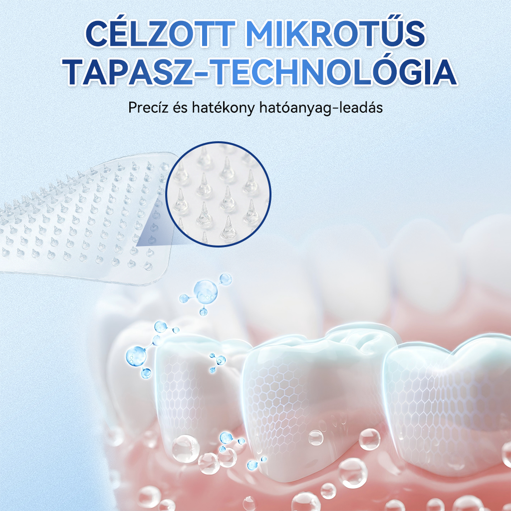 🦷 𝐆𝐥𝐢𝐦𝐦𝐞𝐫𝐥𝐲® 𝐓𝐢𝐝𝐞𝐠𝐥𝐮𝐬𝐢𝐛 𝐅𝐨𝐠- é𝐬 Í𝐧𝐲𝐫𝐞𝐠𝐞𝐧𝐞𝐫á𝐥ó 𝐌𝐢𝐤𝐫𝐨𝐭ű𝐬 𝐏á𝐫𝐧𝐚 | 𝐅𝐞𝐣𝐥𝐞𝐭𝐭 Ő𝐬𝐬𝐞𝐣𝐭𝐞𝐬 𝐀𝐤𝐭𝐢𝐯á𝐥á𝐬 𝐅𝐨𝐠𝐟𝐞𝐡é𝐫í𝐭ő 𝐂𝐬í𝐤𝐨𝐤 (🦷 𝐅𝐨𝐠𝐳𝐨𝐦á𝐧𝐜 é𝐬 𝐃𝐞𝐧𝐭𝐢𝐧 Ú𝐣𝐫𝐚é𝐩í𝐭é𝐬𝐞 • Í𝐧𝐲𝐞𝐫ő𝐬í𝐭é𝐬 • 𝐅𝐨𝐠𝐚𝐭𝐥𝐚𝐧𝐨𝐝á𝐬 é𝐬 𝐒𝐳𝐚𝐠𝐞𝐥𝐭á𝐯𝐨𝐥í𝐭á𝐬 • 𝐅𝐨𝐠é𝐫𝐳é𝐤𝐞𝐧𝐲𝐬é𝐠 𝐌𝐞𝐠á𝐥𝐥í𝐭á𝐬𝐚)🦷