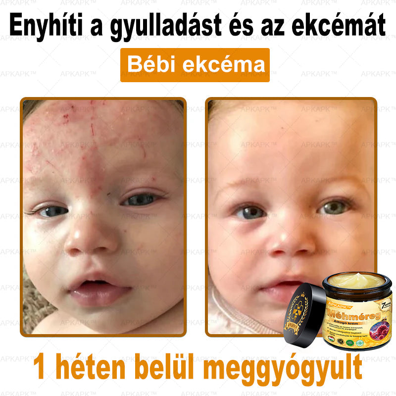 𝐀𝐏𝐊𝐀𝐏𝐊® 𝐌é𝐡𝐦é𝐫𝐞𝐠 Á𝐭𝐟𝐨𝐠ó 𝐤𝐫é𝐦 (🐝𝐬𝐞𝐠í𝐭 𝐦𝐞𝐠𝐨𝐥𝐝𝐚𝐧𝐢 𝐚𝐳 𝐚𝐥á𝐛𝐛𝐢 𝐛ő𝐫𝐩𝐫𝐨𝐛𝐥é𝐦á𝐤𝐚𝐭: 𝐫á𝐧𝐜𝐨𝐤, 𝐡𝐞𝐠𝐞𝐤, 𝐩𝐢𝐠𝐦𝐞𝐧𝐭𝐟𝐨𝐥𝐭𝐨𝐤, 𝐬𝐭𝐫𝐢á𝐤, 𝐩𝐚𝐭𝐭𝐚𝐧á𝐬𝐨𝐤, 𝐩𝐢𝐤𝐤𝐞𝐥𝐲𝐬ö𝐦ö𝐫, 𝐞𝐤𝐜é𝐦𝐚, 𝐛ő𝐫𝐞𝐥𝐯á𝐥𝐭𝐨𝐳á𝐬𝐨𝐤, 𝐢𝐫𝐫𝐢𝐭á𝐜𝐢ó𝐤, 𝐠𝐲𝐮𝐥𝐥𝐚𝐝á𝐬𝐨𝐤 é𝐬 𝐞𝐠𝐲é𝐛 𝐛ő𝐫𝐩𝐚𝐧𝐚𝐬𝐳𝐨𝐤)🔥