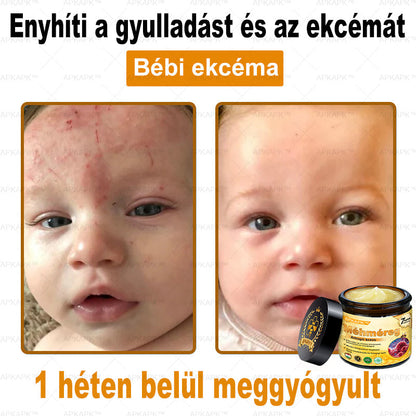 𝐀𝐏𝐊𝐀𝐏𝐊® 𝐌é𝐡𝐦é𝐫𝐞𝐠 Á𝐭𝐟𝐨𝐠ó 𝐤𝐫é𝐦 (🐝𝐬𝐞𝐠í𝐭 𝐦𝐞𝐠𝐨𝐥𝐝𝐚𝐧𝐢 𝐚𝐳 𝐚𝐥á𝐛𝐛𝐢 𝐛ő𝐫𝐩𝐫𝐨𝐛𝐥é𝐦á𝐤𝐚𝐭: 𝐫á𝐧𝐜𝐨𝐤, 𝐡𝐞𝐠𝐞𝐤, 𝐩𝐢𝐠𝐦𝐞𝐧𝐭𝐟𝐨𝐥𝐭𝐨𝐤, 𝐬𝐭𝐫𝐢á𝐤, 𝐩𝐚𝐭𝐭𝐚𝐧á𝐬𝐨𝐤, 𝐩𝐢𝐤𝐤𝐞𝐥𝐲𝐬ö𝐦ö𝐫, 𝐞𝐤𝐜é𝐦𝐚, 𝐛ő𝐫𝐞𝐥𝐯á𝐥𝐭𝐨𝐳á𝐬𝐨𝐤, 𝐢𝐫𝐫𝐢𝐭á𝐜𝐢ó𝐤, 𝐠𝐲𝐮𝐥𝐥𝐚𝐝á𝐬𝐨𝐤 é𝐬 𝐞𝐠𝐲é𝐛 𝐛ő𝐫𝐩𝐚𝐧𝐚𝐬𝐳𝐨𝐤)🔥