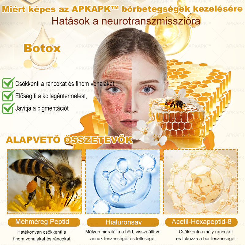 𝐀𝐏𝐊𝐀𝐏𝐊® 𝐌é𝐡𝐦é𝐫𝐞𝐠 Á𝐭𝐟𝐨𝐠ó 𝐤𝐫é𝐦 (🐝𝐬𝐞𝐠í𝐭 𝐦𝐞𝐠𝐨𝐥𝐝𝐚𝐧𝐢 𝐚𝐳 𝐚𝐥á𝐛𝐛𝐢 𝐛ő𝐫𝐩𝐫𝐨𝐛𝐥é𝐦á𝐤𝐚𝐭: 𝐫á𝐧𝐜𝐨𝐤, 𝐡𝐞𝐠𝐞𝐤, 𝐩𝐢𝐠𝐦𝐞𝐧𝐭𝐟𝐨𝐥𝐭𝐨𝐤, 𝐬𝐭𝐫𝐢á𝐤, 𝐩𝐚𝐭𝐭𝐚𝐧á𝐬𝐨𝐤, 𝐩𝐢𝐤𝐤𝐞𝐥𝐲𝐬ö𝐦ö𝐫, 𝐞𝐤𝐜é𝐦𝐚, 𝐛ő𝐫𝐞𝐥𝐯á𝐥𝐭𝐨𝐳á𝐬𝐨𝐤, 𝐢𝐫𝐫𝐢𝐭á𝐜𝐢ó𝐤, 𝐠𝐲𝐮𝐥𝐥𝐚𝐝á𝐬𝐨𝐤 é𝐬 𝐞𝐠𝐲é𝐛 𝐛ő𝐫𝐩𝐚𝐧𝐚𝐬𝐳𝐨𝐤)🔥