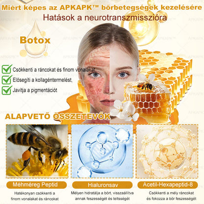 𝐀𝐏𝐊𝐀𝐏𝐊® 𝐌é𝐡𝐦é𝐫𝐞𝐠 Á𝐭𝐟𝐨𝐠ó 𝐤𝐫é𝐦 (🐝𝐬𝐞𝐠í𝐭 𝐦𝐞𝐠𝐨𝐥𝐝𝐚𝐧𝐢 𝐚𝐳 𝐚𝐥á𝐛𝐛𝐢 𝐛ő𝐫𝐩𝐫𝐨𝐛𝐥é𝐦á𝐤𝐚𝐭: 𝐫á𝐧𝐜𝐨𝐤, 𝐡𝐞𝐠𝐞𝐤, 𝐩𝐢𝐠𝐦𝐞𝐧𝐭𝐟𝐨𝐥𝐭𝐨𝐤, 𝐬𝐭𝐫𝐢á𝐤, 𝐩𝐚𝐭𝐭𝐚𝐧á𝐬𝐨𝐤, 𝐩𝐢𝐤𝐤𝐞𝐥𝐲𝐬ö𝐦ö𝐫, 𝐞𝐤𝐜é𝐦𝐚, 𝐛ő𝐫𝐞𝐥𝐯á𝐥𝐭𝐨𝐳á𝐬𝐨𝐤, 𝐢𝐫𝐫𝐢𝐭á𝐜𝐢ó𝐤, 𝐠𝐲𝐮𝐥𝐥𝐚𝐝á𝐬𝐨𝐤 é𝐬 𝐞𝐠𝐲é𝐛 𝐛ő𝐫𝐩𝐚𝐧𝐚𝐬𝐳𝐨𝐤)🔥