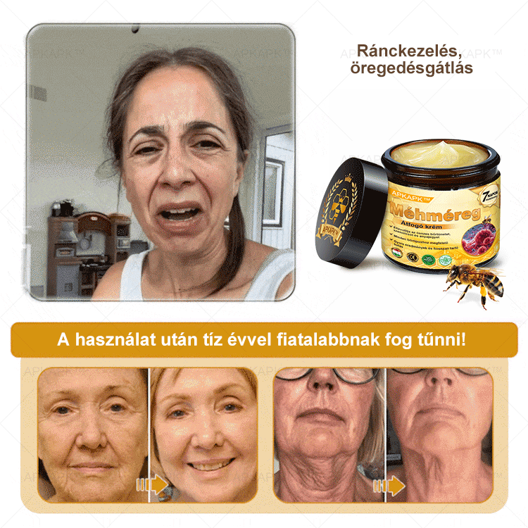 𝐀𝐏𝐊𝐀𝐏𝐊® 𝐌é𝐡𝐦é𝐫𝐞𝐠 Á𝐭𝐟𝐨𝐠ó 𝐤𝐫é𝐦 (🐝𝐬𝐞𝐠í𝐭 𝐦𝐞𝐠𝐨𝐥𝐝𝐚𝐧𝐢 𝐚𝐳 𝐚𝐥á𝐛𝐛𝐢 𝐛ő𝐫𝐩𝐫𝐨𝐛𝐥é𝐦á𝐤𝐚𝐭: 𝐫á𝐧𝐜𝐨𝐤, 𝐡𝐞𝐠𝐞𝐤, 𝐩𝐢𝐠𝐦𝐞𝐧𝐭𝐟𝐨𝐥𝐭𝐨𝐤, 𝐬𝐭𝐫𝐢á𝐤, 𝐩𝐚𝐭𝐭𝐚𝐧á𝐬𝐨𝐤, 𝐩𝐢𝐤𝐤𝐞𝐥𝐲𝐬ö𝐦ö𝐫, 𝐞𝐤𝐜é𝐦𝐚, 𝐛ő𝐫𝐞𝐥𝐯á𝐥𝐭𝐨𝐳á𝐬𝐨𝐤, 𝐢𝐫𝐫𝐢𝐭á𝐜𝐢ó𝐤, 𝐠𝐲𝐮𝐥𝐥𝐚𝐝á𝐬𝐨𝐤 é𝐬 𝐞𝐠𝐲é𝐛 𝐛ő𝐫𝐩𝐚𝐧𝐚𝐬𝐳𝐨𝐤)🔥
