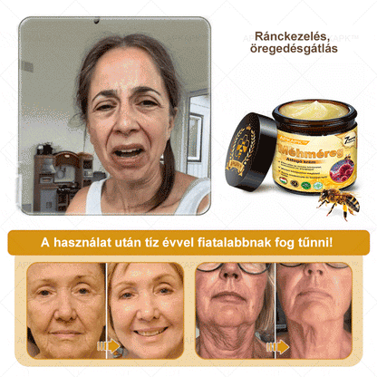 𝐀𝐏𝐊𝐀𝐏𝐊® 𝐌é𝐡𝐦é𝐫𝐞𝐠 Á𝐭𝐟𝐨𝐠ó 𝐤𝐫é𝐦 (🐝𝐬𝐞𝐠í𝐭 𝐦𝐞𝐠𝐨𝐥𝐝𝐚𝐧𝐢 𝐚𝐳 𝐚𝐥á𝐛𝐛𝐢 𝐛ő𝐫𝐩𝐫𝐨𝐛𝐥é𝐦á𝐤𝐚𝐭: 𝐫á𝐧𝐜𝐨𝐤, 𝐡𝐞𝐠𝐞𝐤, 𝐩𝐢𝐠𝐦𝐞𝐧𝐭𝐟𝐨𝐥𝐭𝐨𝐤, 𝐬𝐭𝐫𝐢á𝐤, 𝐩𝐚𝐭𝐭𝐚𝐧á𝐬𝐨𝐤, 𝐩𝐢𝐤𝐤𝐞𝐥𝐲𝐬ö𝐦ö𝐫, 𝐞𝐤𝐜é𝐦𝐚, 𝐛ő𝐫𝐞𝐥𝐯á𝐥𝐭𝐨𝐳á𝐬𝐨𝐤, 𝐢𝐫𝐫𝐢𝐭á𝐜𝐢ó𝐤, 𝐠𝐲𝐮𝐥𝐥𝐚𝐝á𝐬𝐨𝐤 é𝐬 𝐞𝐠𝐲é𝐛 𝐛ő𝐫𝐩𝐚𝐧𝐚𝐬𝐳𝐨𝐤)🔥