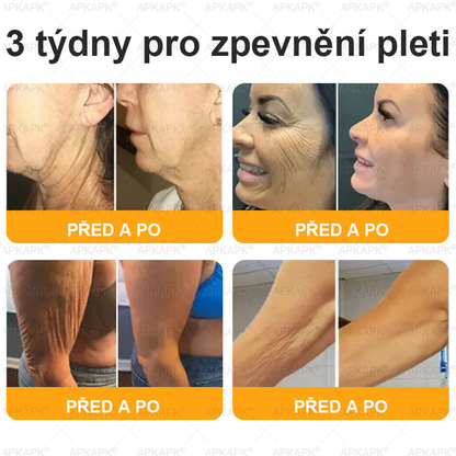 𝐀𝐏𝐊𝐀𝐏𝐊® 𝐌é𝐡𝐦é𝐫𝐞𝐠 Á𝐭𝐟𝐨𝐠ó 𝐤𝐫é𝐦 (🐝𝐬𝐞𝐠í𝐭 𝐦𝐞𝐠𝐨𝐥𝐝𝐚𝐧𝐢 𝐚𝐳 𝐚𝐥á𝐛𝐛𝐢 𝐛ő𝐫𝐩𝐫𝐨𝐛𝐥é𝐦á𝐤𝐚𝐭: 𝐫á𝐧𝐜𝐨𝐤, 𝐡𝐞𝐠𝐞𝐤, 𝐩𝐢𝐠𝐦𝐞𝐧𝐭𝐟𝐨𝐥𝐭𝐨𝐤, 𝐬𝐭𝐫𝐢á𝐤, 𝐩𝐚𝐭𝐭𝐚𝐧á𝐬𝐨𝐤, 𝐩𝐢𝐤𝐤𝐞𝐥𝐲𝐬ö𝐦ö𝐫, 𝐞𝐤𝐜é𝐦𝐚, 𝐛ő𝐫𝐞𝐥𝐯á𝐥𝐭𝐨𝐳á𝐬𝐨𝐤, 𝐢𝐫𝐫𝐢𝐭á𝐜𝐢ó𝐤, 𝐠𝐲𝐮𝐥𝐥𝐚𝐝á𝐬𝐨𝐤 é𝐬 𝐞𝐠𝐲é𝐛 𝐛ő𝐫𝐩𝐚𝐧𝐚𝐬𝐳𝐨𝐤)🔥