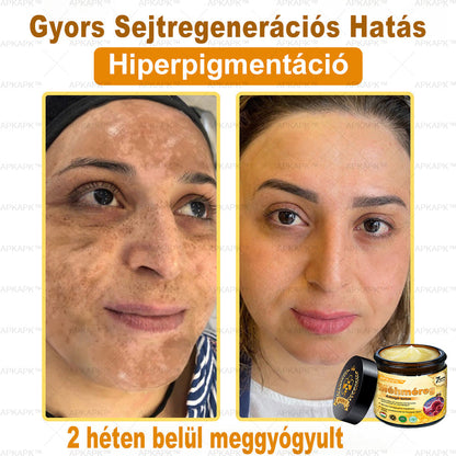 𝐀𝐏𝐊𝐀𝐏𝐊® 𝐌é𝐡𝐦é𝐫𝐞𝐠 Á𝐭𝐟𝐨𝐠ó 𝐤𝐫é𝐦 (🐝𝐬𝐞𝐠í𝐭 𝐦𝐞𝐠𝐨𝐥𝐝𝐚𝐧𝐢 𝐚𝐳 𝐚𝐥á𝐛𝐛𝐢 𝐛ő𝐫𝐩𝐫𝐨𝐛𝐥é𝐦á𝐤𝐚𝐭: 𝐫á𝐧𝐜𝐨𝐤, 𝐡𝐞𝐠𝐞𝐤, 𝐩𝐢𝐠𝐦𝐞𝐧𝐭𝐟𝐨𝐥𝐭𝐨𝐤, 𝐬𝐭𝐫𝐢á𝐤, 𝐩𝐚𝐭𝐭𝐚𝐧á𝐬𝐨𝐤, 𝐩𝐢𝐤𝐤𝐞𝐥𝐲𝐬ö𝐦ö𝐫, 𝐞𝐤𝐜é𝐦𝐚, 𝐛ő𝐫𝐞𝐥𝐯á𝐥𝐭𝐨𝐳á𝐬𝐨𝐤, 𝐢𝐫𝐫𝐢𝐭á𝐜𝐢ó𝐤, 𝐠𝐲𝐮𝐥𝐥𝐚𝐝á𝐬𝐨𝐤 é𝐬 𝐞𝐠𝐲é𝐛 𝐛ő𝐫𝐩𝐚𝐧𝐚𝐬𝐳𝐨𝐤)🔥