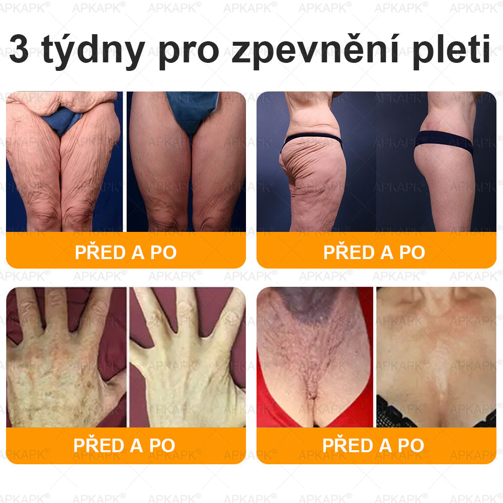 𝐀𝐏𝐊𝐀𝐏𝐊® 𝐌é𝐡𝐦é𝐫𝐞𝐠 Á𝐭𝐟𝐨𝐠ó 𝐤𝐫é𝐦 (🐝𝐬𝐞𝐠í𝐭 𝐦𝐞𝐠𝐨𝐥𝐝𝐚𝐧𝐢 𝐚𝐳 𝐚𝐥á𝐛𝐛𝐢 𝐛ő𝐫𝐩𝐫𝐨𝐛𝐥é𝐦á𝐤𝐚𝐭: 𝐫á𝐧𝐜𝐨𝐤, 𝐡𝐞𝐠𝐞𝐤, 𝐩𝐢𝐠𝐦𝐞𝐧𝐭𝐟𝐨𝐥𝐭𝐨𝐤, 𝐬𝐭𝐫𝐢á𝐤, 𝐩𝐚𝐭𝐭𝐚𝐧á𝐬𝐨𝐤, 𝐩𝐢𝐤𝐤𝐞𝐥𝐲𝐬ö𝐦ö𝐫, 𝐞𝐤𝐜é𝐦𝐚, 𝐛ő𝐫𝐞𝐥𝐯á𝐥𝐭𝐨𝐳á𝐬𝐨𝐤, 𝐢𝐫𝐫𝐢𝐭á𝐜𝐢ó𝐤, 𝐠𝐲𝐮𝐥𝐥𝐚𝐝á𝐬𝐨𝐤 é𝐬 𝐞𝐠𝐲é𝐛 𝐛ő𝐫𝐩𝐚𝐧𝐚𝐬𝐳𝐨𝐤)🔥