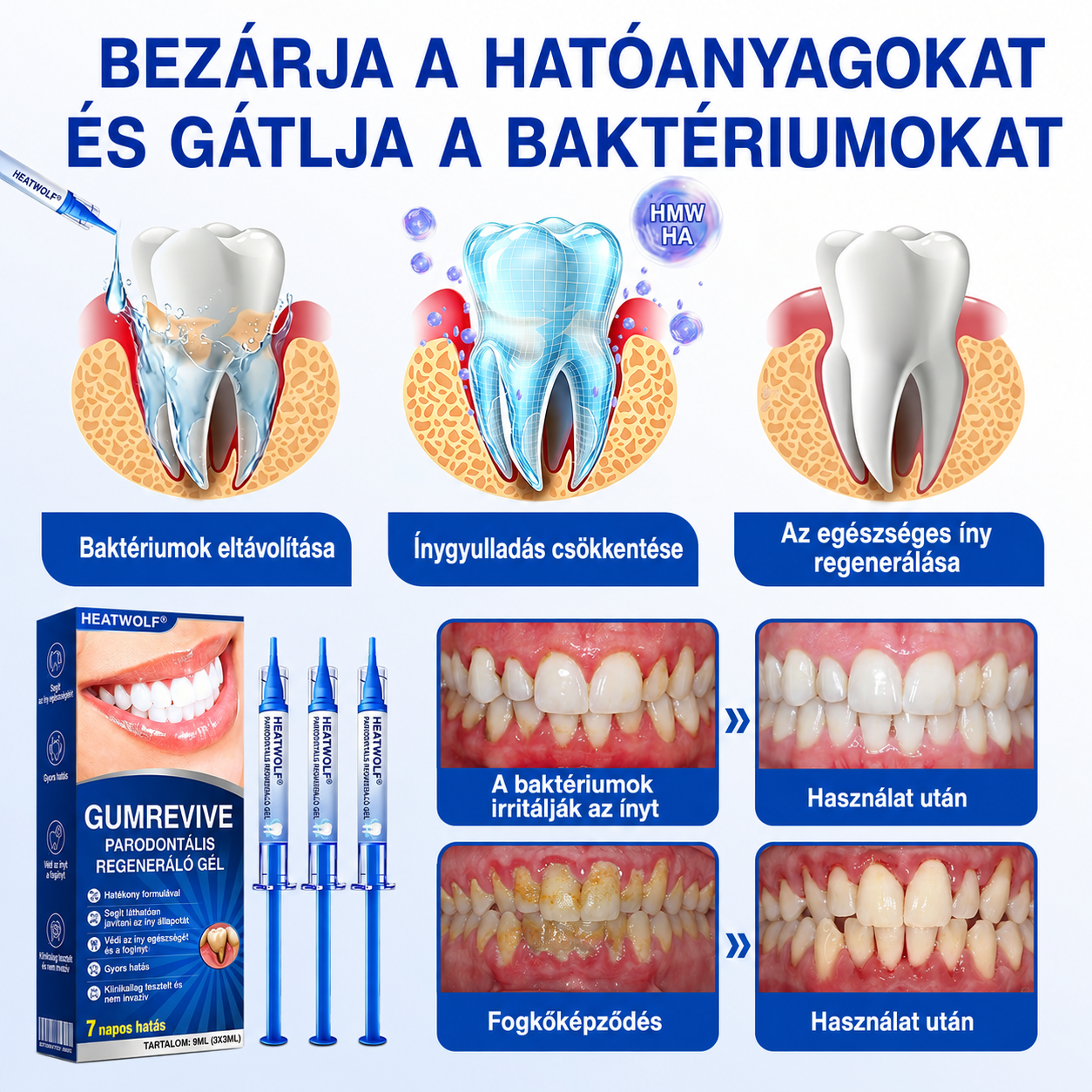 🇭🇺👨‍⚕️✅🦷 HEATWOLF® GumRevive – Parodontális helyreállító gél🍿