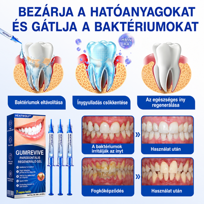 🇭🇺👨‍⚕️✅🦷 HEATWOLF® GumRevive – Parodontális helyreállító gél🍿