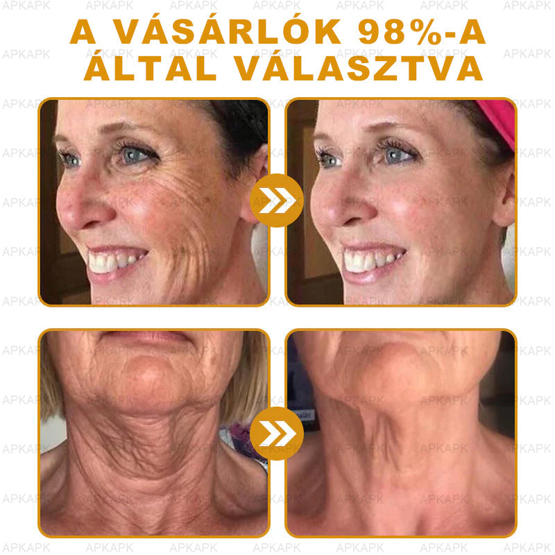 𝐀𝐏𝐊𝐀𝐏𝐊® 𝐌é𝐡𝐦é𝐫𝐞𝐠 Á𝐭𝐟𝐨𝐠ó 𝐤𝐫é𝐦 (🐝𝐬𝐞𝐠í𝐭 𝐦𝐞𝐠𝐨𝐥𝐝𝐚𝐧𝐢 𝐚𝐳 𝐚𝐥á𝐛𝐛𝐢 𝐛ő𝐫𝐩𝐫𝐨𝐛𝐥é𝐦á𝐤𝐚𝐭: 𝐫á𝐧𝐜𝐨𝐤, 𝐡𝐞𝐠𝐞𝐤, 𝐩𝐢𝐠𝐦𝐞𝐧𝐭𝐟𝐨𝐥𝐭𝐨𝐤, 𝐬𝐭𝐫𝐢á𝐤, 𝐩𝐚𝐭𝐭𝐚𝐧á𝐬𝐨𝐤, 𝐩𝐢𝐤𝐤𝐞𝐥𝐲𝐬ö𝐦ö𝐫, 𝐞𝐤𝐜é𝐦𝐚, 𝐛ő𝐫𝐞𝐥𝐯á𝐥𝐭𝐨𝐳á𝐬𝐨𝐤, 𝐢𝐫𝐫𝐢𝐭á𝐜𝐢ó𝐤, 𝐠𝐲𝐮𝐥𝐥𝐚𝐝á𝐬𝐨𝐤 é𝐬 𝐞𝐠𝐲é𝐛 𝐛ő𝐫𝐩𝐚𝐧𝐚𝐬𝐳𝐨𝐤)🔥