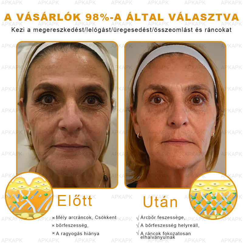 𝐀𝐏𝐊𝐀𝐏𝐊® 𝐌é𝐡𝐦é𝐫𝐞𝐠 Á𝐭𝐟𝐨𝐠ó 𝐤𝐫é𝐦 (🐝𝐬𝐞𝐠í𝐭 𝐦𝐞𝐠𝐨𝐥𝐝𝐚𝐧𝐢 𝐚𝐳 𝐚𝐥á𝐛𝐛𝐢 𝐛ő𝐫𝐩𝐫𝐨𝐛𝐥é𝐦á𝐤𝐚𝐭: 𝐫á𝐧𝐜𝐨𝐤, 𝐡𝐞𝐠𝐞𝐤, 𝐩𝐢𝐠𝐦𝐞𝐧𝐭𝐟𝐨𝐥𝐭𝐨𝐤, 𝐬𝐭𝐫𝐢á𝐤, 𝐩𝐚𝐭𝐭𝐚𝐧á𝐬𝐨𝐤, 𝐩𝐢𝐤𝐤𝐞𝐥𝐲𝐬ö𝐦ö𝐫, 𝐞𝐤𝐜é𝐦𝐚, 𝐛ő𝐫𝐞𝐥𝐯á𝐥𝐭𝐨𝐳á𝐬𝐨𝐤, 𝐢𝐫𝐫𝐢𝐭á𝐜𝐢ó𝐤, 𝐠𝐲𝐮𝐥𝐥𝐚𝐝á𝐬𝐨𝐤 é𝐬 𝐞𝐠𝐲é𝐛 𝐛ő𝐫𝐩𝐚𝐧𝐚𝐬𝐳𝐨𝐤)🔥